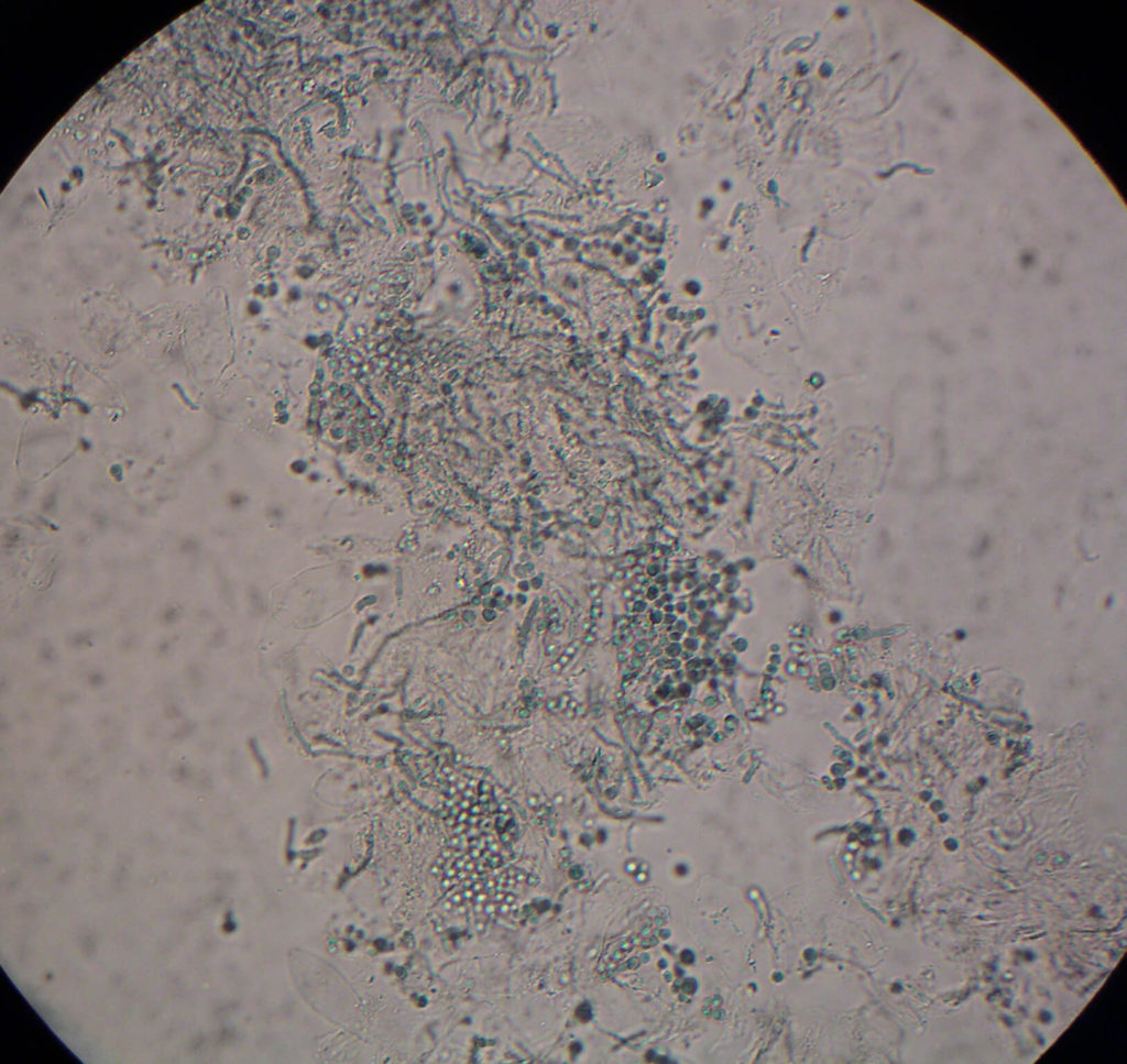 Gisten onder de microscoop: "Spaghetti and meatballs"