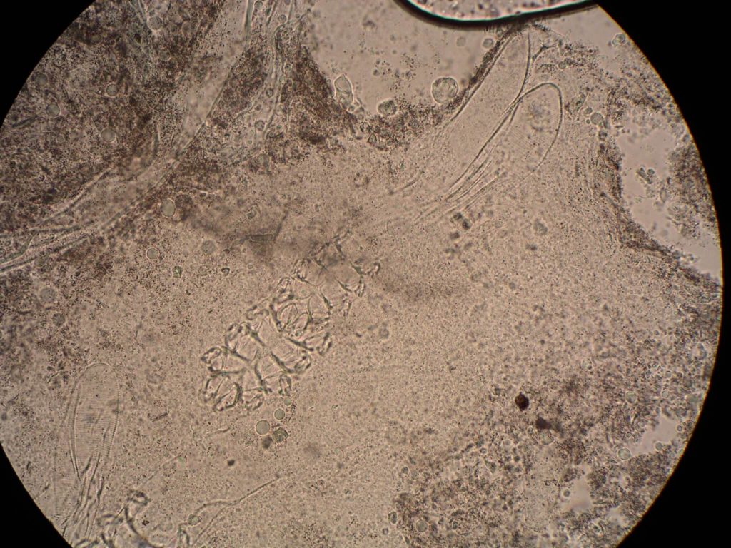 Huidschilfers onder de microscoop: Demodex mijten en eitjes