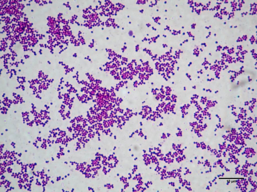 Stafylokokken bacteriën onder een microscoop, typisch "druivetrossen" beeld